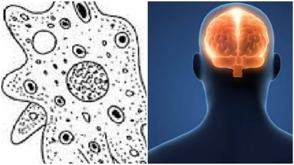 അമീബിക് മസ്തിഷ്ക ജ്വരം ബാധിച്ച 14 കാരന് രോ​ഗം ഭേ​ദമായി; ലോകത്ത് തന്നെ രോ​ഗമുക്തി നേടിയത് 11 പേർ
