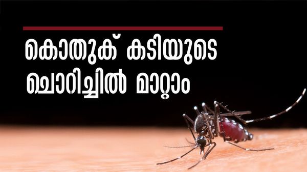 കൊതുക് കടിയുടെ ചൊറിച്ചിലും വീക്കവും മാറുന്നില്ലേ..!? ടൂത്ത് പേസ്റ്റ് മുതല്‍ ഉള്ളി വരെ നിങ്ങളെ സഹായിക്കും