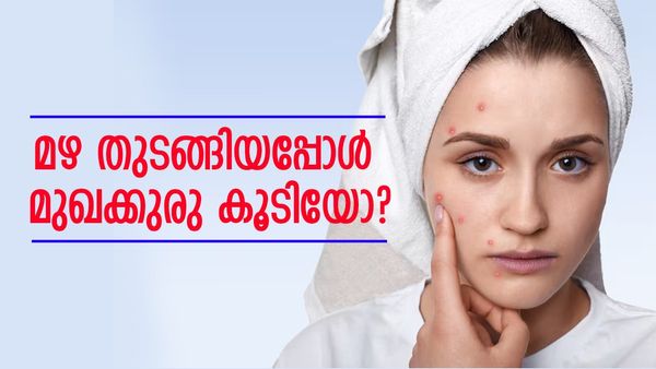 മഴക്കാലമാണ്, മുഖക്കുരു കൂടിയെങ്കിൽ, ഇന്ന് തന്നെ ഇക്കാര്യങ്ങൾ ചെയ്തോളൂ; മുഖക്കുരു ഇല്ലാതാക്കാം