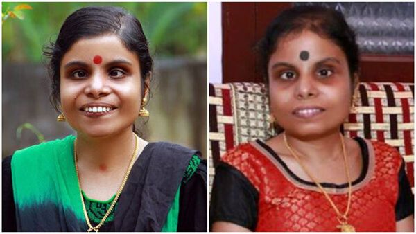 'ആ പ്രതീക്ഷയിലാണ് ഞാൻ ഇപ്പോൾ, പുനർ വിവാഹത്തെക്കുറിച്ച് ആലോചിക്കുന്നുണ്ട്, പക്ഷേ'; വൈക്കം വിജയലക്ഷ്മി