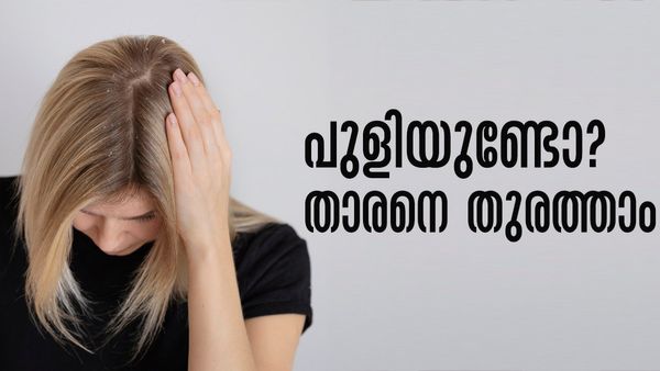 താരനാണോ നിങ്ങളെ വലയ്ക്കുന്നത്..? ഒരൊറ്റ കഷ്ണം പുളി മതി, താരനെ എന്നന്നേക്കുമായി ഓടിക്കാം