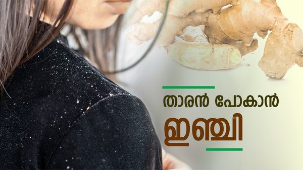 ഇഞ്ചിയും കഞ്ഞിവെള്ളവും മതി, താരൻ എന്നെന്നേക്കുമായി ഇല്ലാതാക്കാം; താരൻ കളയാൻ വീട്ടിലുണ്ട് മാർ​ഗം