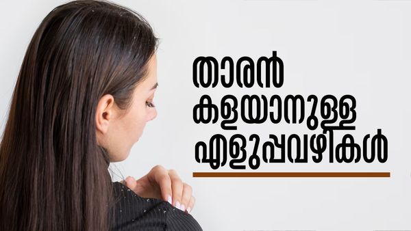 താരനെ തുരത്താന്‍ എളുപ്പവഴിയുണ്ട്; മഴക്കാലത്ത് ഇങ്ങനെ ചെയ്താല്‍ മതി..!