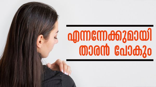 താരന്‍ പോകാന്‍ ഇതിലും നല്ല മാര്‍ഗം വേറെയുണ്ടോ..? തൈരും ഉലുവയും എടുത്തോളൂ