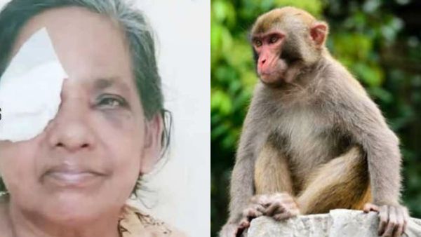 കുരങ്ങ് തേങ്ങ പറിച്ച്‌ എറിഞ്ഞു; വീട്ടമ്മയുടെ കണ്ണിന് പരിക്കേറ്റു, അടിയന്തര ശസ്ത്രക്രിയക്ക് വിധേയയാക്കി