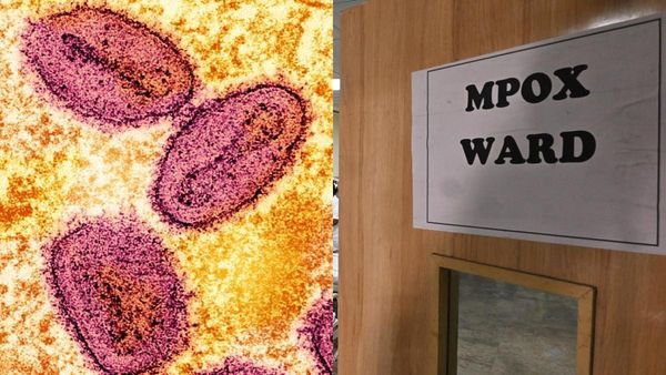 ഇന്ത്യയിൽ എംപോക്‌സ് ബാധ സ്ഥിരീകരിച്ചു; രോഗബാധിതൻ ഡൽഹിയിൽ ചികിത്സയിൽ, ഒറ്റപ്പെട്ട കേസെന്ന് കേന്ദ്രം