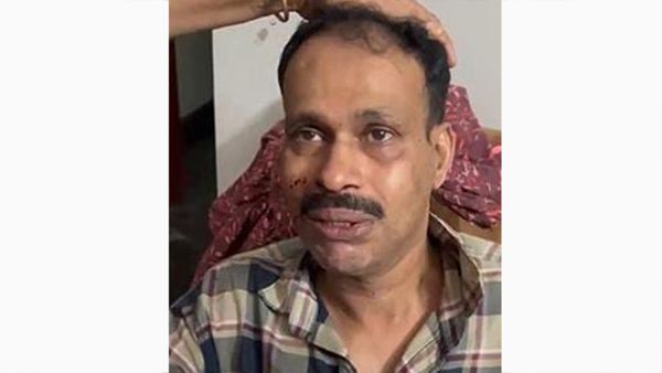 വ്യാപാരിയെ തട്ടിക്കൊണ്ടു പോയി കൊള്ളയടിച്ച സംഭവത്തില്‍ അന്വേഷണം ഊര്‍ജ്ജിതമാക്കി