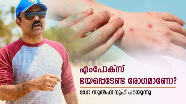 മങ്കിപോക്സ് കൊവിഡ് പോലെ പകരുമോ, രോഗത്തെ ഭയക്കണോ?;ഡോ സുൽഫി നൂഹു പറയുന്നു