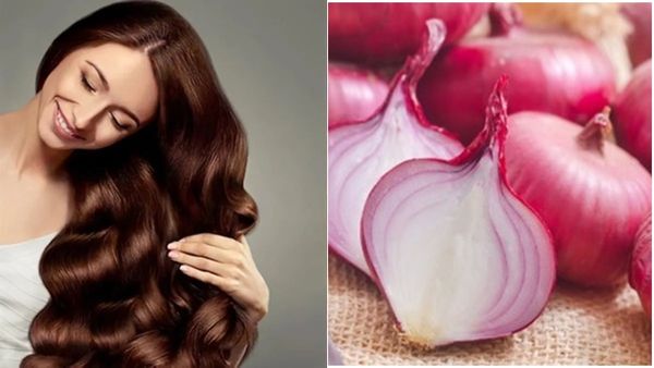 മുടി മുഴുവൻ കൊഴിഞ്ഞ് മൊട്ടയാകാറായോ? ഉള്ളിവെള്ളം ഉള്ളപ്പോൾ ഇനി ടെൻഷൻ വേണ്ട