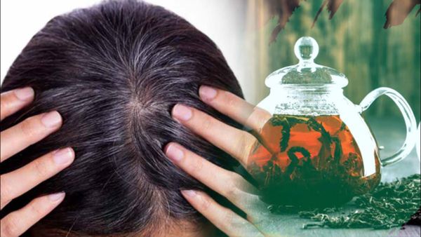 'ബേബി ഹെയര്‍' വളരുന്നില്ലേ; പരിഹാരമാര്‍ഗങ്ങള്‍ ഇവിടെയുണ്ട്