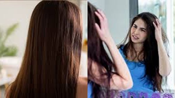 മുടി കൊഴിയുന്നത് ഈ വിറ്റാമിന്റെ കുറവ് കൊണ്ടാണ്; ഇവ കഴിച്ചാൽ പ്രശ്നം പരിഹരിക്കാം