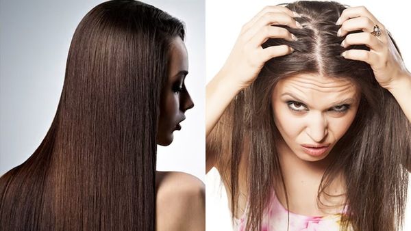 മുടി കൊഴിയുന്നുവെന്ന് ഇനി വിഷമിക്കേണ്ട; ഈ അഞ്ച് ഭക്ഷണങ്ങൾ കഴിക്കൂ, പരിഹാരം ഉടൻ