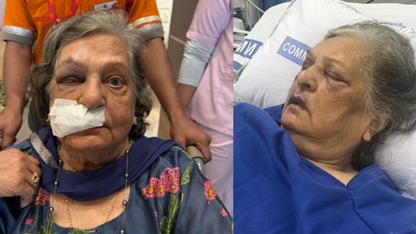 എയര്‍ ഇന്ത്യ വയോധികയ്ക്ക് വീല്‍ചെയര്‍ അനുവദിച്ചില്ല; നടക്കുന്നതിനിടെ മുഖമടിച്ച് വീണ് ഗുരുതര പരിക്ക്