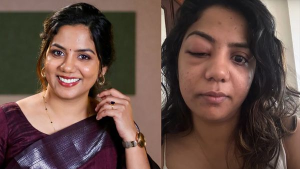 ഇതുകൊണ്ടാണ് ഗയ്‌സ് ഞാന്‍ കൂളിംഗ് ഗ്ലാസ് വെച്ചത്, മറ്റ് വഴിയില്ലായിരുന്നു; വീണ മുകുന്ദന്‍ പറയുന്നു