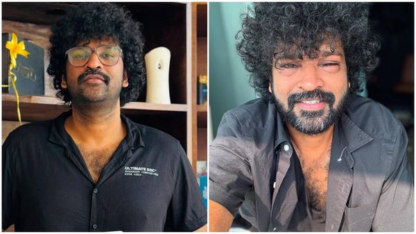 അശ്വന്ത് കോക്കിന് എന്തുപറ്റി? പുതിയ ചിത്രം കണ്ട് ഞെട്ടൽ, 'ഇടി കിട്ടിയോ?'