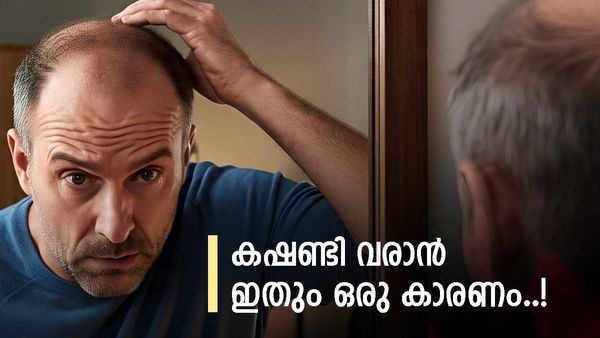 സ്വന്തം കഷണ്ടി കണ്ട് ബോധം പോയോ? വെറുതെ ഇരുന്നാൽ മാറില്ല, ഡയറ്റിലും ശ്രദ്ധ വേണം, ചെയ്യേണ്ടത് ഇതൊക്കെ