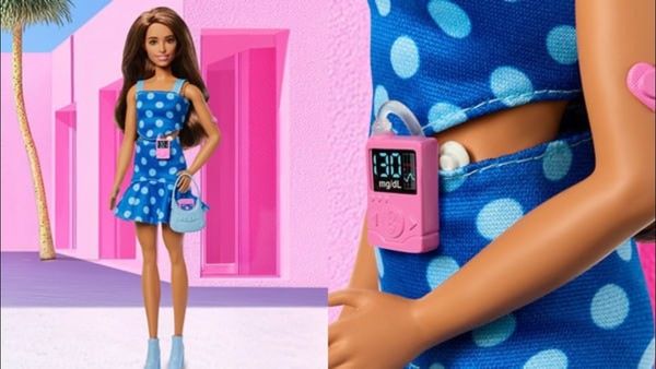 ഇനി പ്രമേഹ രോഗിയായ ബാര്‍ബി പാവയും: ശരീരത്തില്‍ ഇന്‍സുലിന്‍ പമ്പും ഗ്ലൂക്കോസ് മോണിറ്ററും