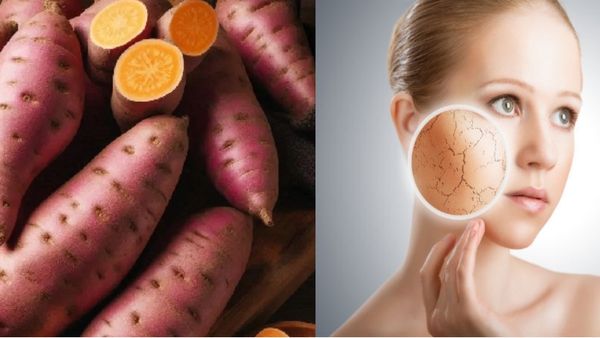 മധുരക്കിഴങ്ങിന് ഇത്രയും ഗുണങ്ങളോ? മുഖം തിളങ്ങാന്‍ ഉഗ്രനൊരു ഫെയ്‌സ് പാക്ക് വീട്ടിലുണ്ടാക്കാം