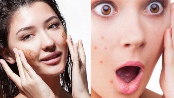 അടുക്കളയിലെ ഈ ഏഴു സാധനങ്ങള്‍ ഒരിക്കലും മുഖത്ത് പുരട്ടരുതേ.. മുഖം പൊത്തി നടക്കേണ്ടി വരും