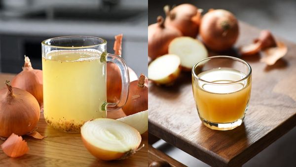 ഉള്ളിനീര് മുടി വളർത്തും, പക്ഷേ രൂക്ഷ ഗന്ധം കഴുകിയിട്ടും മാറുന്നില്ലേ? വഴിയുണ്ട്