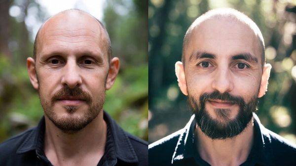 കഷണ്ടിക്ക് മരുന്നില്ല എന്ന വിഷമം ഇനി വേണ്ട, പരീക്ഷണത്തിൽ പുതിയ കണ്ടുപിടുത്തം, ഇനി കഷണ്ടിക്ക് വിട