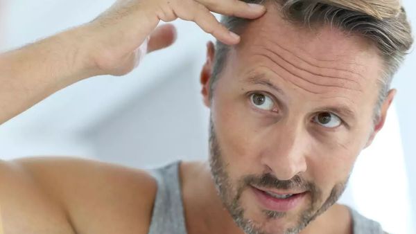 കഷണ്ടി വരുന്നത് പ്രായം കൊണ്ടല്ല, ഈ ശീലം കൊണ്ടാണ്! ഉടൻ നിർത്തൂ