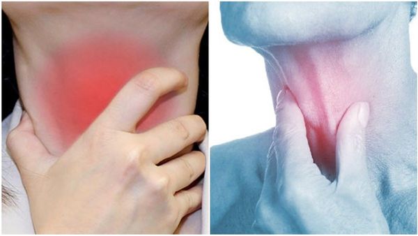 തൊണ്ട വേദന ഇടയ്ക്കിടെ വരുന്നുണ്ടോ? ഇങ്ങനെ ചില നാട്ടുവൈദ്യമുണ്ട്, പരീക്ഷിച്ചുനോക്കൂ, പക്ഷേ