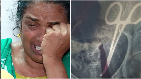 വണ്ടാനം മെഡിക്കൽ കോളേജിന്റെ ക്രൂരത; വയറ്റിൽ കത്രികയുമായി യുവതി കഴിഞ്ഞത് 5 വർഷം