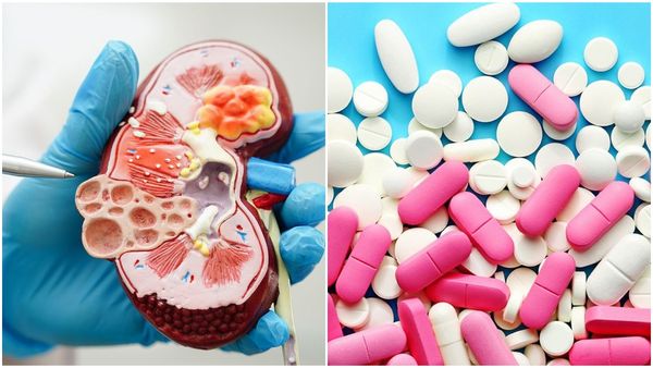 നിങ്ങൾ കഴിക്കുന്ന ഈ ഗുളികകൾ വൃക്കയെ തകർക്കും; ഡോക്ടറുടെ മുന്നറിയിപ്പ്