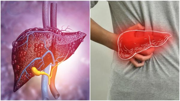 ഫാസ്റ്റ് ഫുഡ് പ്രിയരാണോ? നിങ്ങൾക്ക് ക്യാൻസർ സാധ്യത ഇരട്ടിയെന്ന് പഠനം