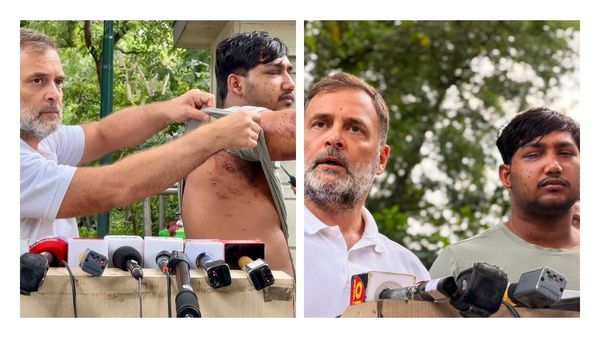 സർക്കാർ നുണ പറയുന്നത് നിർത്തൂ, പെല്ലറ്റ് ആക്രമണത്തിൽ പരിക്കേറ്റ യുവാവുമായി രാഹുൽ ഗാന്ധി, 'കണ്ണിന് കാഴ്ച പോയി'