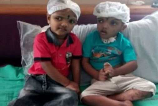 ଯୋଡା ମୁଣ୍ଡ ଶିଶୁ କାଳିଆର ମୃତ୍ୟୁ