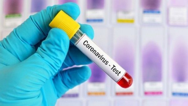 ରାଜ୍ୟରେ କମୁଛି କରୋନା ସଂକ୍ରମଣ ସଂଖ୍ୟା, ଗତକାଲି 749 ସଂକ୍ରମିତ