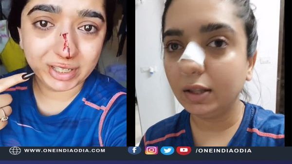 ମହିଳାଙ୍କ ନାକ ଭାଙ୍ଗିଥିବା Zomato ବଏ ଗିରଫ । ପୀଡିତାଙ୍କୁ କମ୍ପାନୀ ମାଗିଲା କ୍ଷମା । କହିଲା..