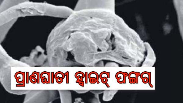 ବ୍ଲାକ ଫଙ୍ଗସ ପରେ ହ୍ବାଇଟ୍‌ ଫଙ୍ଗସ ଆତଙ୍କ ; ବିହାରରେ 4 ରୋଗୀ ଚିହ୍ନଟ