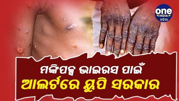 ଚିନ୍ତା ବଢାଉଛି ମଙ୍କିପକ୍ସ ଭାଇରସ, ବିଦେଶ ଫେରନ୍ତାଙ୍କ ଉପରେ ନଜର ରଖିବାକୁ ନିର୍ଦ୍ଦେଶ