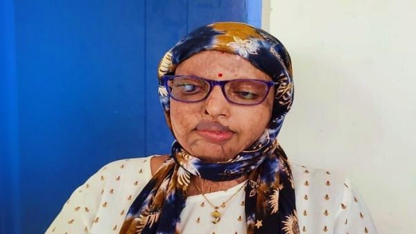 ପ୍ରମୋଦିନୀ ରାଉଳ ଏସିଡ୍ ମାଡ଼ ଘଟଣା: ୨ ଅଭିଯୁକ୍ତଙ୍କୁ ୧୪ ବର୍ଷ ଜେଲ୍ ଦଣ୍ଡାଦେଶ