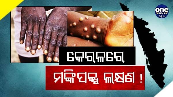 କେରଳରେ ବ୍ୟକ୍ତିଙ୍କ ଠାରେ ଦେଖାଦେଲା ମଙ୍କିପକ୍ସ ଲକ୍ଷଣ, ପୁଣେର ଲ୍ୟାବକୁ ପଠାଗଲା ନମୁନା