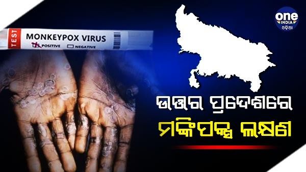ଉତ୍ତର ପ୍ରଦେଶ ଔରୈୟା ଜିଲ୍ଲାରେ ମଙ୍କିପକ୍ସର ସନ୍ଦେହଜନକ ମାମଲା, ଲକ୍ଷ୍ନୌ ପଠାଗଲା ନମୁନା