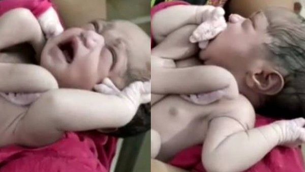 ଅଦ୍ଭୁତ ଶିଶୁକୁ ଜନ୍ମ ଦେଲେ ମହିଳା