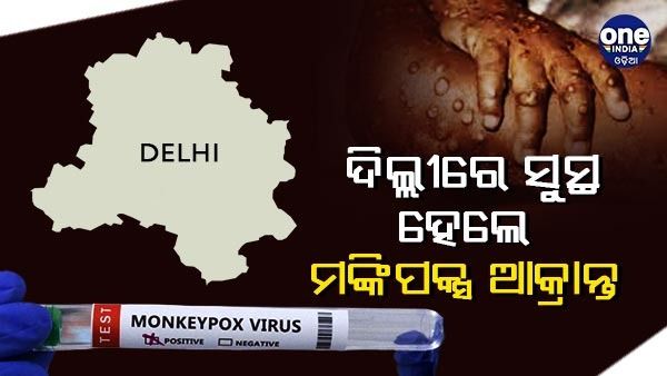 ଦିଲ୍ଲୀର ଡାକ୍ତରଖାନାରୁ ଡିସଚାର୍ଜ ହେଲେ ମଙ୍କିପକ୍ସର ପ୍ରଥମ ରୋଗୀ, ଏତେ ଦିନର ଚିକିତ୍ସା ପରେ ହେଲେ ସୁସ୍ଥ