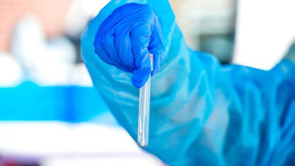 କରୋନା ଅପଡେଟ୍: ଦେଶରେ 2,468 ଟି ନୂତନ କୋଭିଡ ମାମଲା ଚିହ୍ନଟ