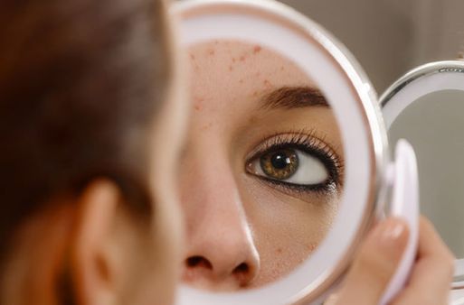 Skin Care Tips:ଆପଣାନ୍ତୁ ଏହି ଉପାୟ, ସେଲିବ୍ରିଟିଙ୍କ ପରି ଚମକିବ ସ୍କିନ୍