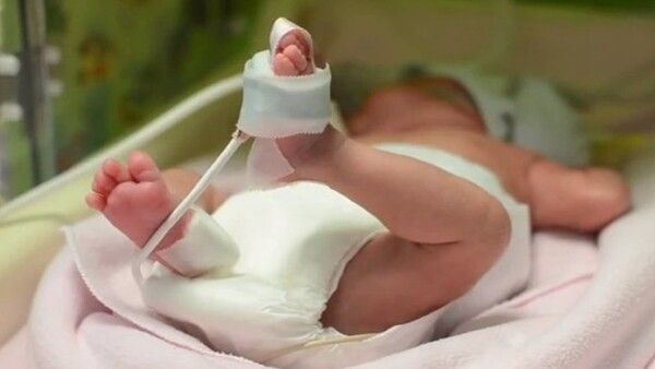 ଭିଡିଓ କଲରେ ଡେଲିଭେରି କଲେ ନର୍ସ, ନବଜାତକର ମୃତ୍ୟୁ