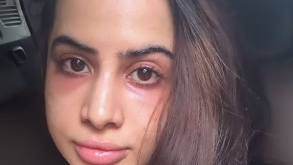 ବିଗିଡିଲା ଅଭିନେତ୍ରୀ ଉର୍ଫିଙ୍କ ଚେହେରା