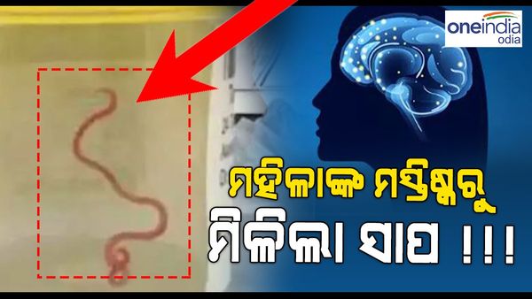 ବିଶ୍ୱରେ ବିରଳ ଘଟଣା: ମହିଳାଙ୍କ ମସ୍ତିଷ୍କରୁ ମିଳିଲା ସାପ ଦେହରେ ଥିବା ପରଜୀବୀ