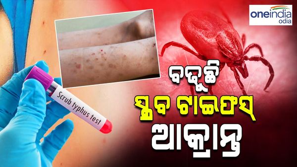 ସ୍କ୍ରବ୍ ଟାଇଫସ୍ ଆତଙ୍କ: ରାଜ୍ୟରେ ଚିନ୍ତା ବଢାଇଛି ସ୍କ୍ରବ୍ ଟାଇଫସ୍, ସୁନ୍ଦରଗଡ଼ରେ 162 ଆକ୍ରାନ୍ତ ଚିହ୍ନଟ