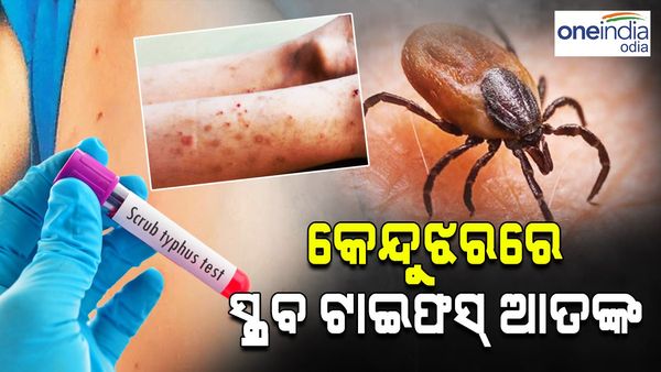 କେନ୍ଦୁଝରରେ ସ୍କ୍ରବ ଟାଇଫସ୍ ଆତଙ୍କ ! 334 ଜଣ ପଡିଟିଭ୍