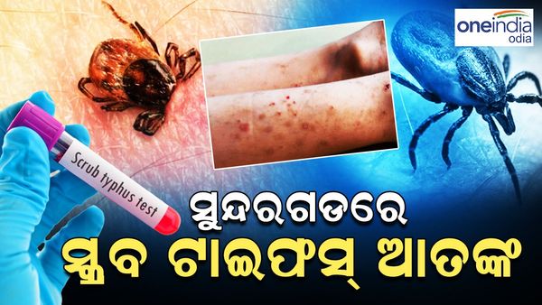 ବଢୁଛି ସ୍କ୍ରବ୍ ଟାଇଫସ୍ ଚିନ୍ତା, ସୁନ୍ଦରଗଡ଼ରେ ଚିହ୍ନଟ ହେଲେ ଆଉ 14 ଆକ୍ରାନ୍ତ