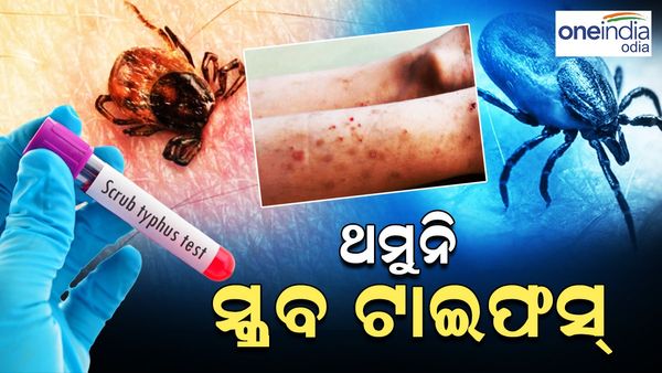 ଥମୁନି ସ୍କ୍ରବ୍ ଟାଇଫସ୍, ସୁନ୍ଦରଗଡ଼ରେ ଆଉ 9 ଆକ୍ରାନ୍ତ ଚିହ୍ନଟ
